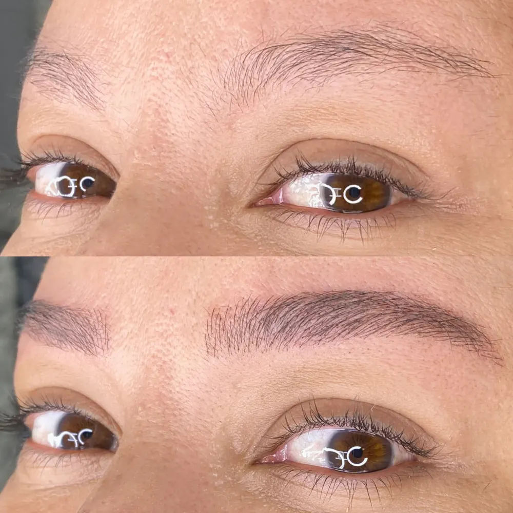 Sobrancelha antes e depois do Nanoblading